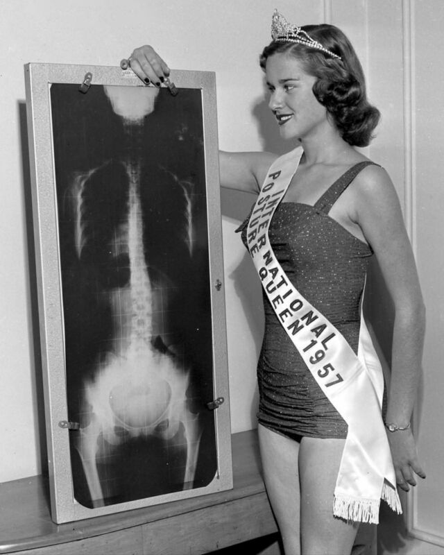 International Posture Queen, 1957. How do you think you’d go? Let us help you be a posture queen or king too! 🤗 Doctors of Chiropractic are trained to realign the spine and body to help gain optimal nervous system and joint function.
Call us on 65831449 or book online www.lakeroadchiro.com.au 
#LakeRoadChiro #PortMacquarieChiro #PortMacquarie #Chiropractor #Chiropractic #EFT #Psychotherapy #SpinalFlow #MindAlignment #Massage #acupuncture #chinesemedicine #acupuncturePortMacquarie